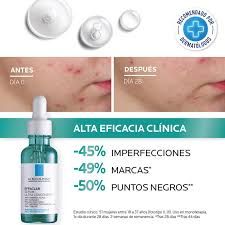 ✨ Sérum Effaclar La Roche-Posay – 100% Original ✨